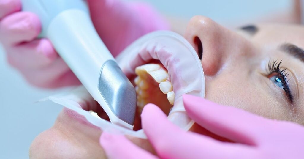 empreintes-3d-orthodontiste